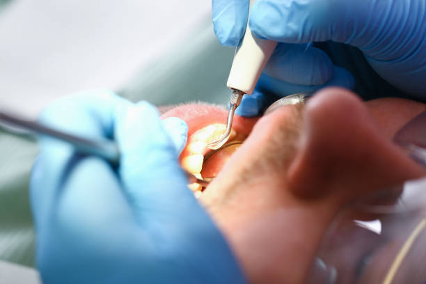 Best Walk-In Emergency Dentist in Serenada, TX