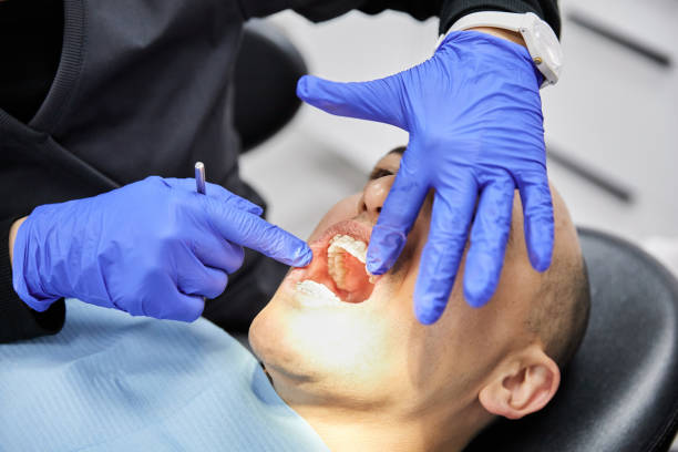 Best Emergency Broken Tooth Repair in Serenada, TX
